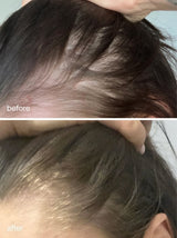 Advanced Scalp Dermaroller - UKLASH